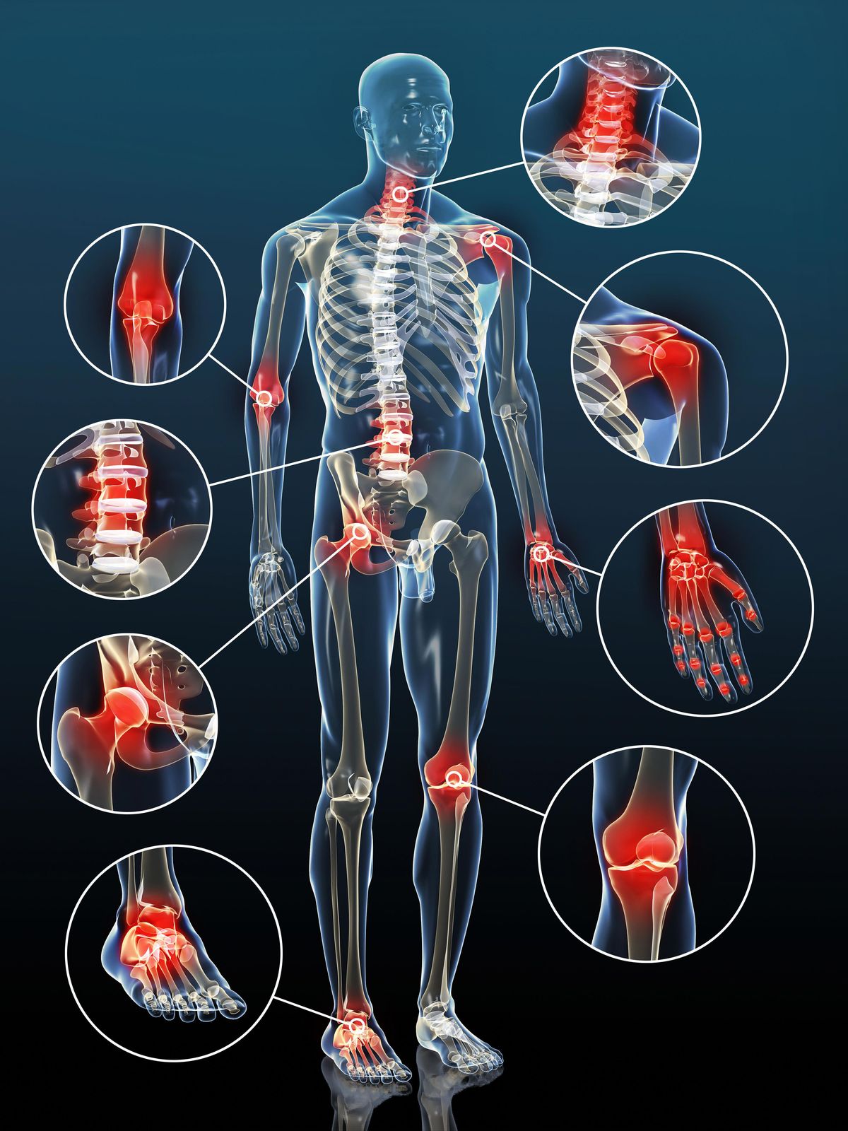 Orthopedics